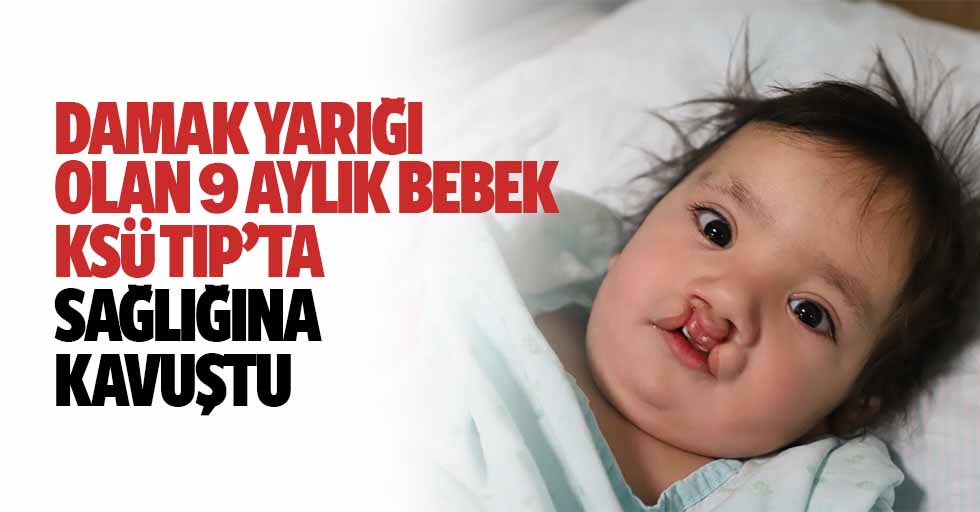 Damak Yarığı Olan 9 Aylık Bebek, Ksü Tıp’ta Sağlığına Kavuştu