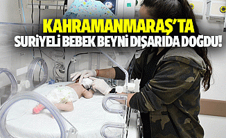 Kahramanmaraş'ta Suriyeli bebek beyni dışarıda doğdu!